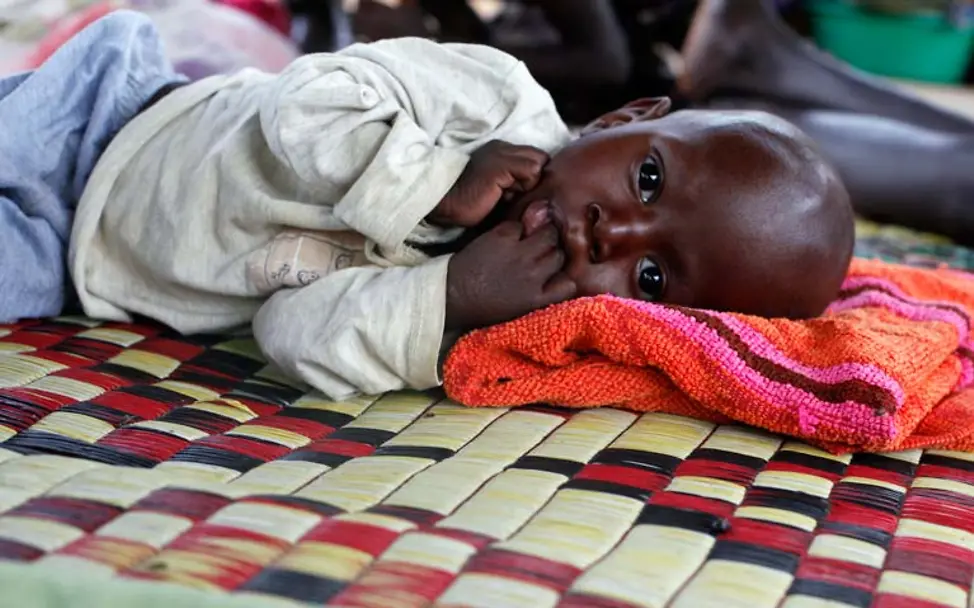 In einem Kinderkrankenhaus im Südsudan kämpfen Kinder um ihr Überleben | © UNICEF/Campeanu Hungersnot Afrika verhindern: Schwer mangelernährte Kinder sind vom Hungertod bedroht. Hilfsorganisationen wie UNICEF helfen.
