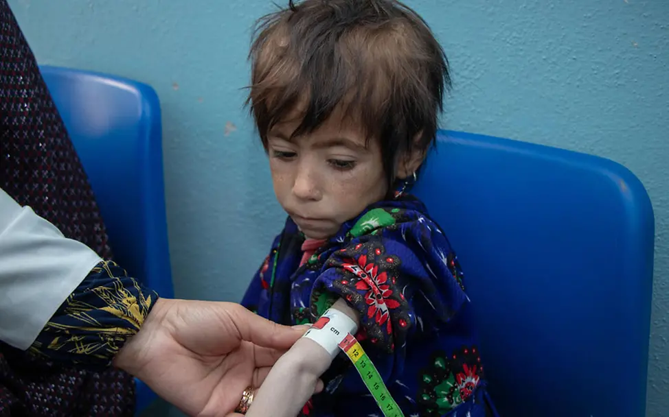 Mangelernährung in Afghanistan: Parwana (4) wird untersucht | © UNICEF/Bidel Mangelernährung in Afghanistan: Parwana (4) wird untersucht