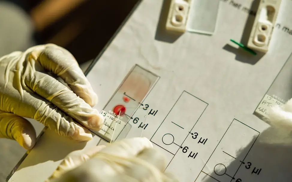 Ein Gesundheitshelfer beim Durchführen von Malaria-Tests. 