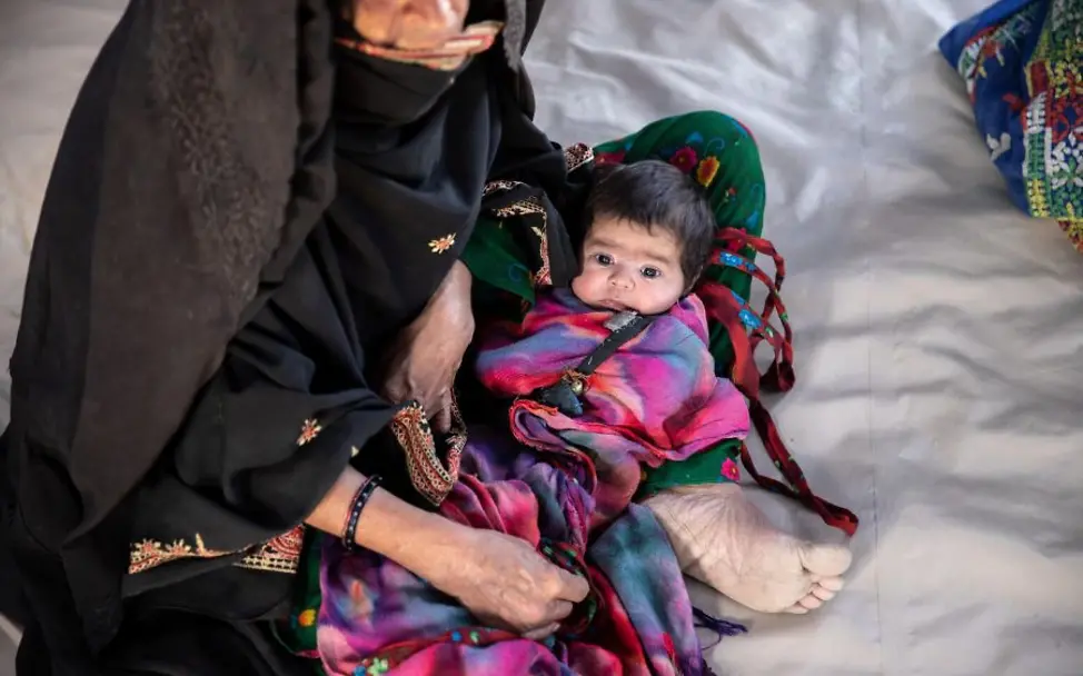 Dürre weltweit bedroht Kinder | © UNICEF/Bidel Dürre: Ein an Cholera erkranktes Mädchen liegt auf dem Schoß seiner Mutter