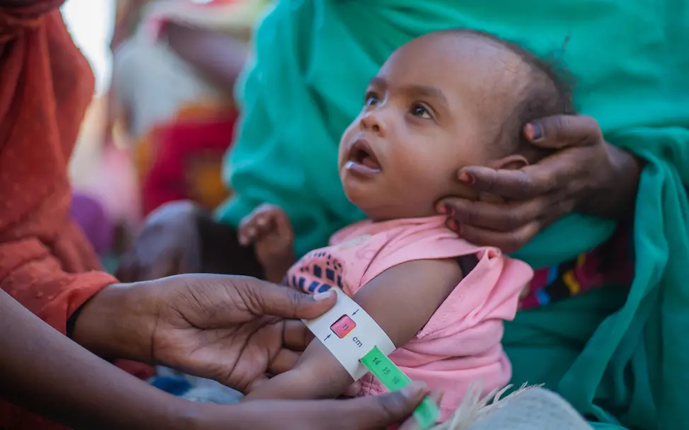 Messung des Armumfanges zur Feststellung von Mangelernährung | UNICEF/UNI529849/Elfatih Einem Kleinkind wird der Armumfang gemessen