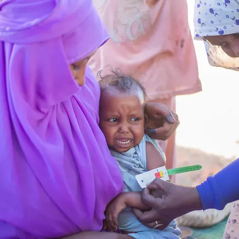 Die Menschen im Sudan befinden sich in einer humanitären Notlage | UNICEF/UNI529918/Elfatih Einem Kleinkind wird der Oberarm gemessen um zu prüfen, ob eine Mangelernährung vorliegt
