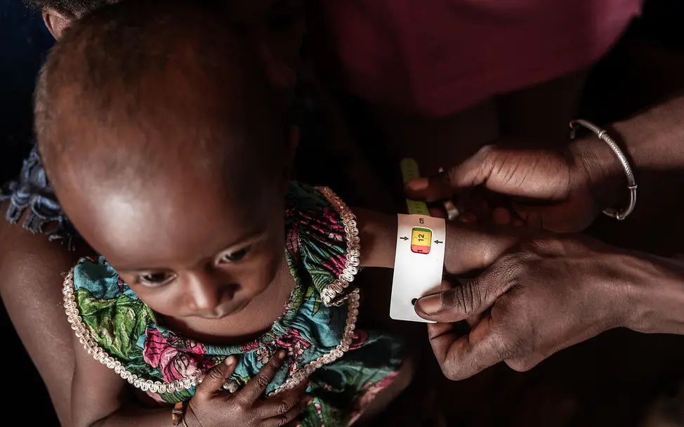 Sambitano bei einer Untersuchung | © UNICEF/UNI658445/Andrianantenaina Einem kleinen Mädchen wird der Oberarm gemessen, um zu prüfen ob sie mangelernährt ist