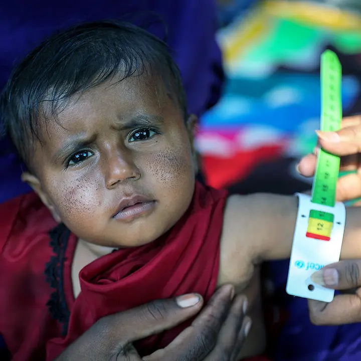 Millionen Kinder weltweit leiden Hunger | © UNICEF/Zaidi Hunger in der Welt: Ein Kleinkind in Pakistan wird auf Mangelernährung getestet