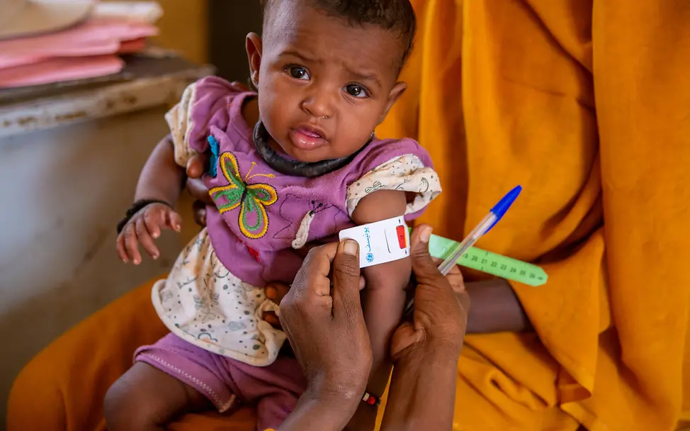 Sudan: Am Oberarm eines Babys wird gemessen, ob es mangelernährt ist | © UNICEF/UNI707410/Rajab Hunger in der Welt: Mangelernährte Babys und Kleinkinder brauchen unsere Hilfe, um zu überleben.