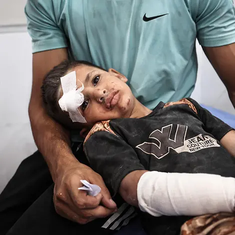 Ein verletzter Junge in Gaza | © UNICEF/UNI799060/El Baba Ein verletzter Junge in Gaza