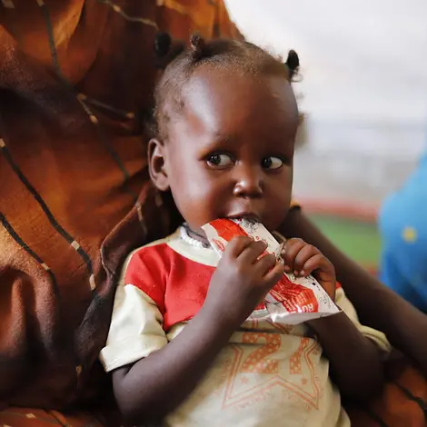 Ein kleines Kind isst aus einer Packung Plumpy Nut