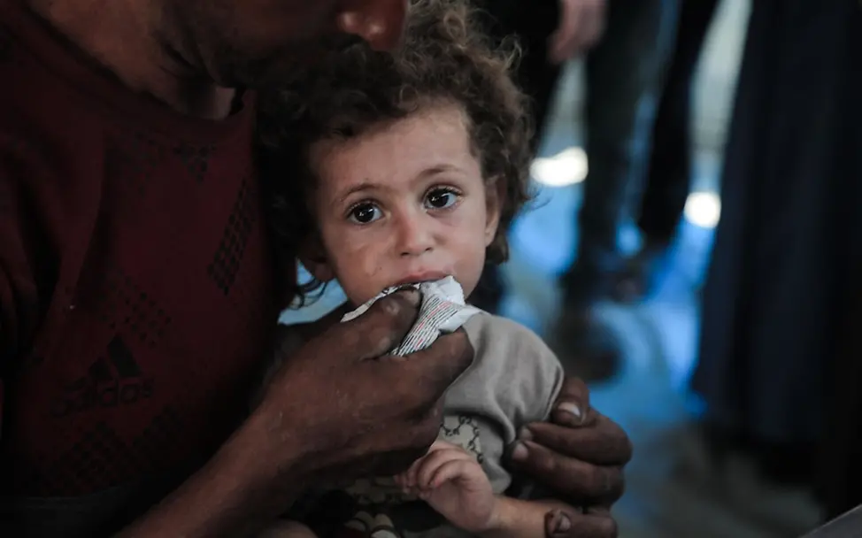 Rund 26.000 Kinder im Gazastreifen benötigen dringend eine Behandlung wegen Mangelernährung | © UNICEF/Nateel News Gaza: Rund 26.000 Kinder im Gazastreifen benötigen dringend eine Behandlung wegen Mangelernährung