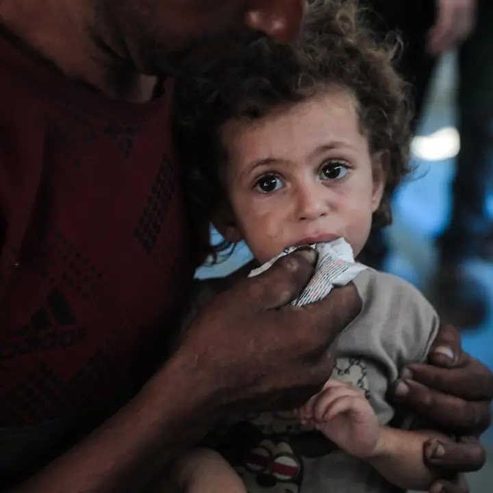 Rund 26.000 Kinder im Gazastreifen benötigen dringend eine Behandlung wegen Mangelernährung | © UNICEF/Nateel News Gaza: Rund 26.000 Kinder im Gazastreifen benötigen dringend eine Behandlung wegen Mangelernährung