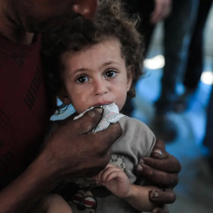 Rund 26.000 Kinder im Gazastreifen benötigen dringend eine Behandlung wegen Mangelernährung | © UNICEF/Nateel News Gaza: Rund 26.000 Kinder im Gazastreifen benötigen dringend eine Behandlung wegen Mangelernährung