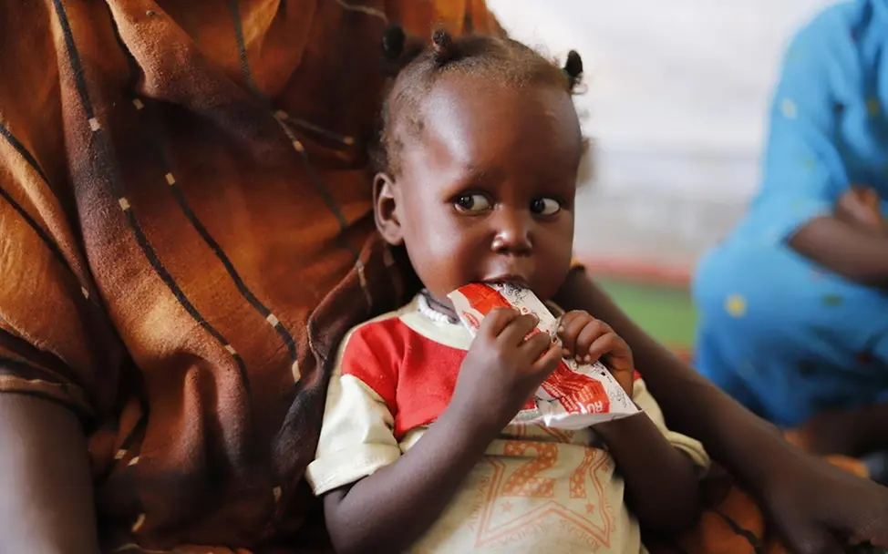 Ein mangelernährtes Kind isst therapeutische Spezialnahrung.