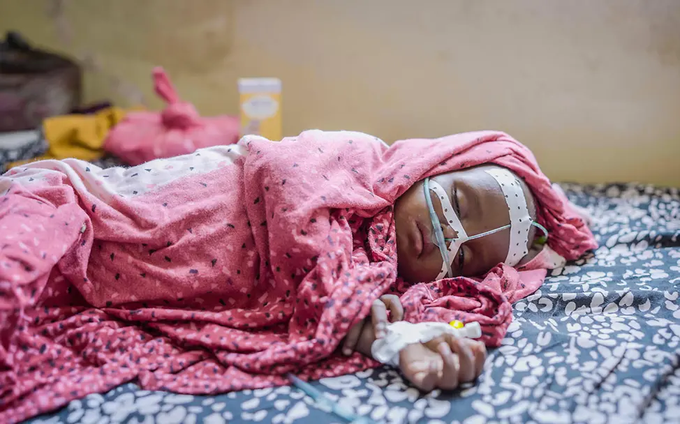 Hungerkrise in Somalia: Ein Kleinkind liegt in einem Krankenhausbett und erhält Sauerstoff.