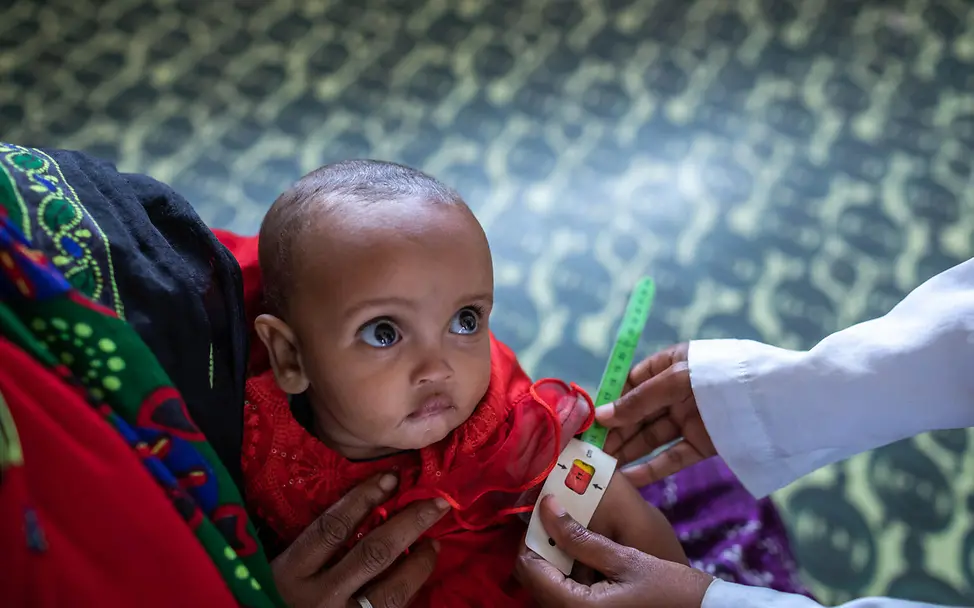 Behandlung Mangelernährung | © UNICEF/UN0724758/Ayene Einem Kleinkind wird der Armumfang gemessen