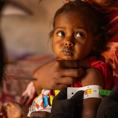 Ein Kind wird auf Mangelernährung untersucht. | © UNICEF/UNI962591/Elfatih Sudan Hungersnot: Oberarmmessung bei Mädchen
