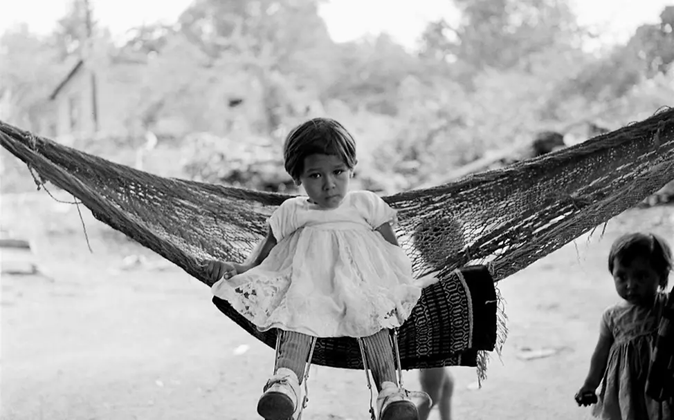 Ein Mädchen in Mexiko nach einer Polio-Infektion, 1960. | © UNICEF/unknown UNICEF 80 Jahre Fotos: Ein Mädchen in Mexiko nach einer Polio-Infektion, 1960.
