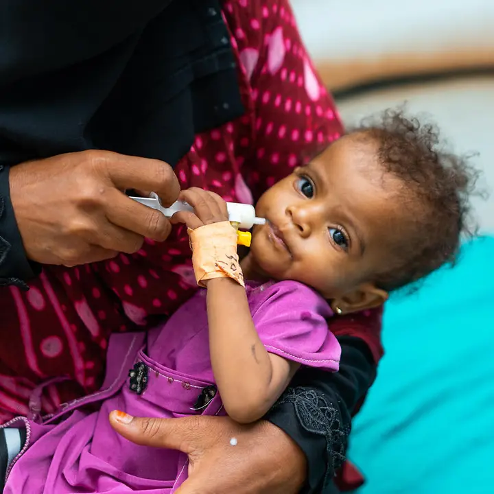Jemen Hungersnot verhindern: Ein mangelernährtes Baby wird mit therapeutischer Spezialmilch gefüttert. 