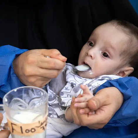 Millionen Kinder auf der Welt haben nicht genug zu essen. | © UNICEF/Meerzad Hunger einfach erklärt: Ein mangelernährtes Baby wird mit Spezialmilch gefüttert.