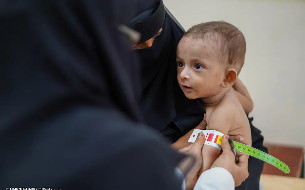 Hunger im Jemen: Ein Baby wird auf dem Arm seiner Mutter auf Mangelernährung untersucht.