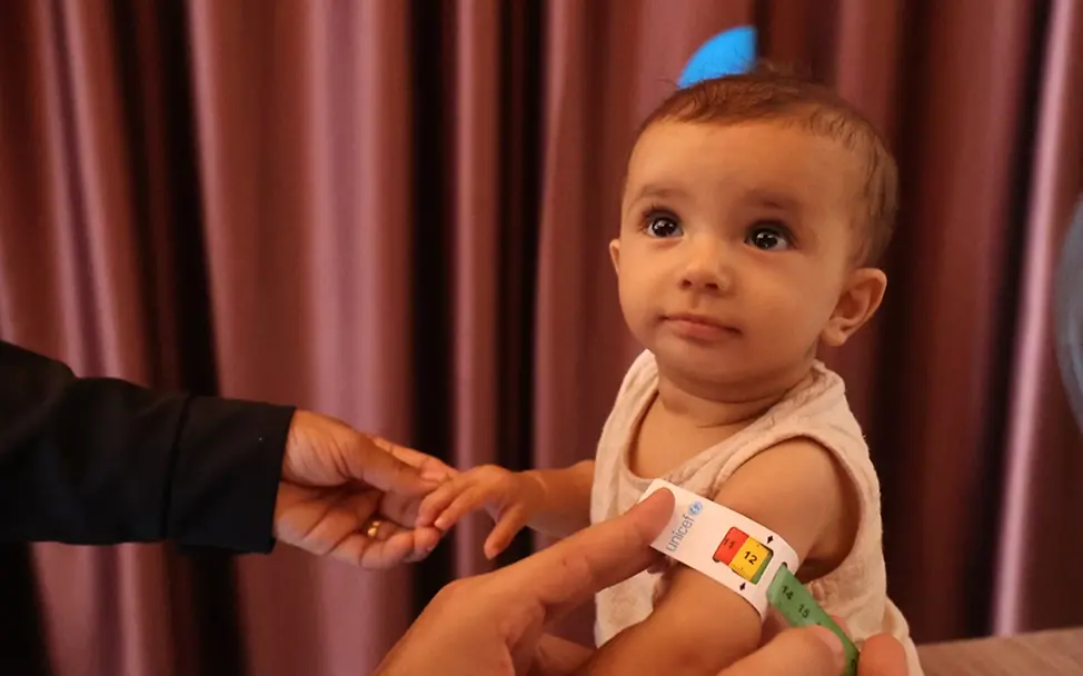 Nour aus Gaza leidet unter Mangelernährung | UNICEF/Ba Defitionen Hungersnot: Nours Oberarm wird mit einem Maßband gemessen
