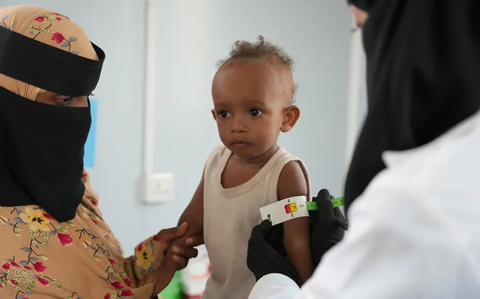 UNICEF setzt weltweit Maßbänder zur Untersuchung von Mangelernährung ein | UNICEF/Saeed Definitionen Hungersnot: Ein Kind im Jemen wird mit einem Maßband auf Mangelernährung untersucht